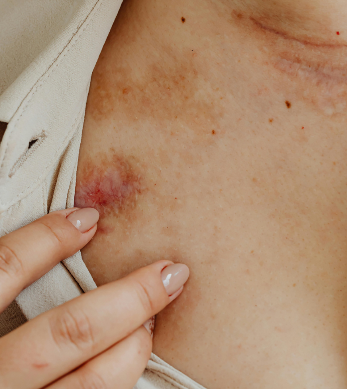 Private minor surgery services